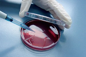 Microbiological tests